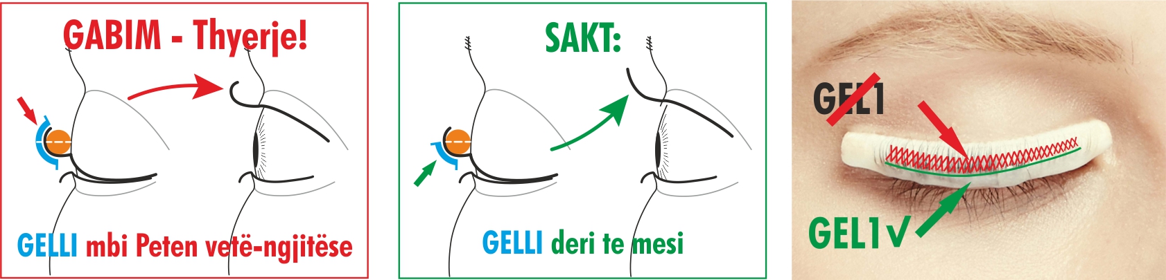 Aplikoni gelin saktë Bild Aplikoni gelin saktë Bild